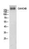 Complement C4A (Rodgers Blood Group) antibody, A01095, Boster Biological Technology, Western Blot image 