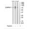Calpain 11 antibody, A12404, Boster Biological Technology, Western Blot image 