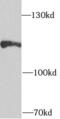 Transient Receptor Potential Cation Channel Subfamily A Member 1 antibody, FNab09013, FineTest, Western Blot image 