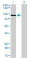 Zw10 Kinetochore Protein antibody, H00009183-M05, Novus Biologicals, Western Blot image 