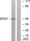 Lpa3 antibody, TA315257, Origene, Western Blot image 