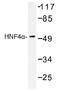 Hnf-4 antibody, AP01345PU-N, Origene, Western Blot image 