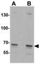 Solute Carrier Family 27 Member 6 antibody, GTX31878, GeneTex, Western Blot image 