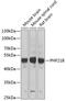PHD Finger Protein 21B antibody, GTX32789, GeneTex, Western Blot image 