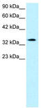 Pro-Apoptotic WT1 Regulator antibody, TA331131, Origene, Western Blot image 