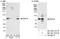 DEAD-Box Helicase 18 antibody, NB100-1722, Novus Biologicals, Western Blot image 