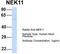 NIMA Related Kinase 11 antibody, TA346831, Origene, Western Blot image 