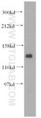Sister chromatid cohesion protein PDS5 homolog A antibody, 17485-1-AP, Proteintech Group, Western Blot image 