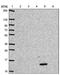 Defensin-5 antibody, PA5-62631, Invitrogen Antibodies, Western Blot image 