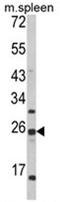 FKBP Prolyl Isomerase 11 antibody, AP18019PU-N, Origene, Western Blot image 