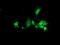 DnaJ Heat Shock Protein Family (Hsp40) Member B2 antibody, NBP2-00638, Novus Biologicals, Immunocytochemistry image 