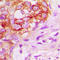 Kinase suppressor of Ras 1 antibody, LS-C358791, Lifespan Biosciences, Immunohistochemistry paraffin image 