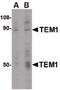 CD248 Molecule antibody, PA5-20436, Invitrogen Antibodies, Western Blot image 