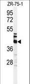 Keratin 35 antibody, LS-C165626, Lifespan Biosciences, Western Blot image 