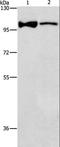 AC-III antibody, LS-C401418, Lifespan Biosciences, Western Blot image 