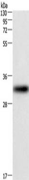Centromere protein P antibody, TA349790, Origene, Western Blot image 