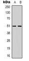 Relaxin Family Peptide Receptor 3 antibody, abx133555, Abbexa, Western Blot image 