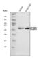 Low affinity immunoglobulin gamma Fc region receptor III antibody, A32617, Boster Biological Technology, Western Blot image 