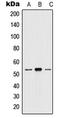 HTR2A antibody, MBS820902, MyBioSource, Western Blot image 