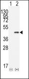 Caudal Type Homeobox 2 antibody, TA302103, Origene, Western Blot image 