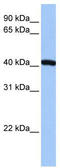 FtsJ RNA 2'-O-Methyltransferase 1 antibody, TA331007, Origene, Western Blot image 