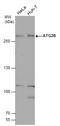 Autophagy Related 2B antibody, GTX132307, GeneTex, Western Blot image 
