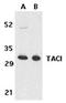 CD267 antibody, ADI-905-312-100, Enzo Life Sciences, Western Blot image 