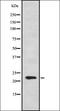 Cytokine receptor-like factor 1 antibody, orb337726, Biorbyt, Western Blot image 