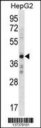 Zinc finger protein AEBP2 antibody, 60-036, ProSci, Western Blot image 