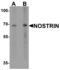 Nitric Oxide Synthase Trafficking antibody, MBS153699, MyBioSource, Western Blot image 