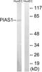 Gbp antibody, LS-C118608, Lifespan Biosciences, Western Blot image 