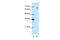 Splicing Factor 1 antibody, ARP41214_T100, Aviva Systems Biology, Western Blot image 
