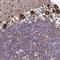 Zinc Finger And BTB Domain Containing 39 antibody, NBP2-13535, Novus Biologicals, Immunohistochemistry frozen image 
