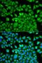 Fatty Acid Binding Protein 1 antibody, LS-C333976, Lifespan Biosciences, Immunofluorescence image 