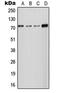 Solute Carrier Family 24 Member 2 antibody, LS-C353359, Lifespan Biosciences, Western Blot image 