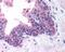FA Complementation Group D2 antibody, NB100-182H, Novus Biologicals, Immunohistochemistry paraffin image 