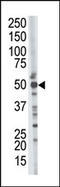 Tumor Susceptibility 101 antibody, AP12055PU-N, Origene, Western Blot image 