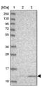 Ubiquinol-Cytochrome C Reductase Hinge Protein antibody, PA5-60030, Invitrogen Antibodies, Western Blot image 
