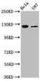 Electrogenic sodium bicarbonate cotransporter 4 antibody, LS-C681377, Lifespan Biosciences, Western Blot image 