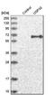 Ubiquitin Specific Peptidase 30 antibody, HPA016952, Atlas Antibodies, Western Blot image 