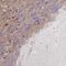 Peroxisomal Biogenesis Factor 5 Like antibody, NBP2-38840, Novus Biologicals, Immunohistochemistry frozen image 