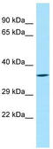 Synaptotagmin 8 antibody, TA337912, Origene, Western Blot image 