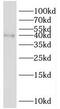 SH3 Domain Containing GRB2 Like 2, Endophilin A1 antibody, FNab07833, FineTest, Western Blot image 