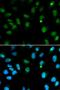 Deoxycytidine kinase antibody, orb48348, Biorbyt, Immunofluorescence image 
