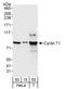 Cyclin T1 antibody, A303-497A, Bethyl Labs, Western Blot image 
