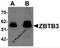 Zinc Finger And BTB Domain Containing 3 antibody, 6119, ProSci, Western Blot image 