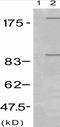 Insulin Like Growth Factor 1 Receptor antibody, TA321219, Origene, Western Blot image 