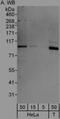 Lethal(3)malignant brain tumor-like protein 3 antibody, NBP1-47314, Novus Biologicals, Immunoprecipitation image 
