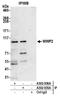 WW Domain Containing E3 Ubiquitin Protein Ligase 2 antibody, A302-936A, Bethyl Labs, Immunoprecipitation image 