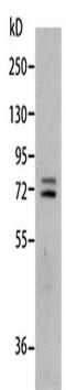Matrix Metallopeptidase 2 antibody, TA350972, Origene, Western Blot image 
